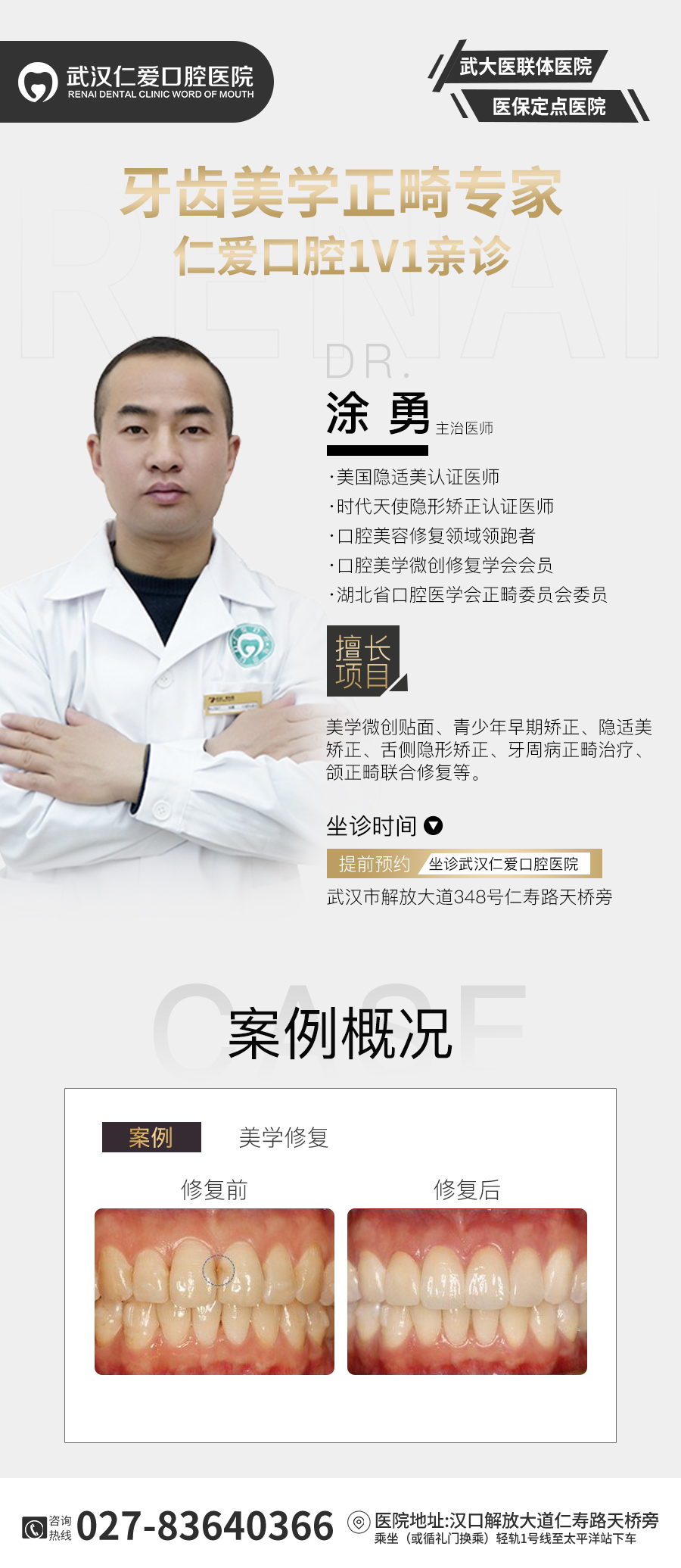 武漢仁愛口腔醫(yī)師:美學(xué)貼面:打造微笑曲線! 涂勇(1).jpg