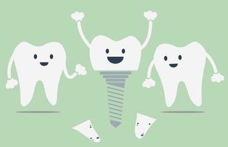 孙明宇科普牙齿缺失可以晚点做种植牙吗