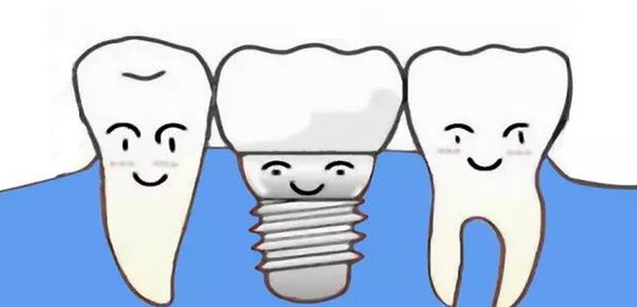 口腔陈昊来告诉你即刻负重种植牙是什么